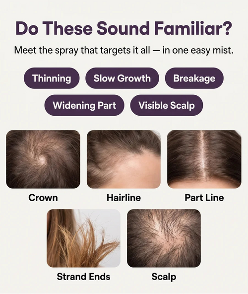 An informational graphic for a hair scalp treatment spray, featuring text that reads 'Do These Sound Familiar? Meet the spray that targets it all — in one easy mist.' with labels for Thinning, Slow Growth, Breakage, Widening Part, and Visible Scalp.